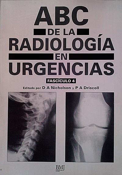 ABC de la radiología en urgencias