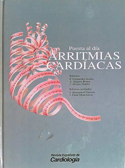 Arritmias cardíacas