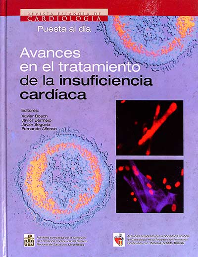Avances en el tratamiento de la insuficiencia cardíaca