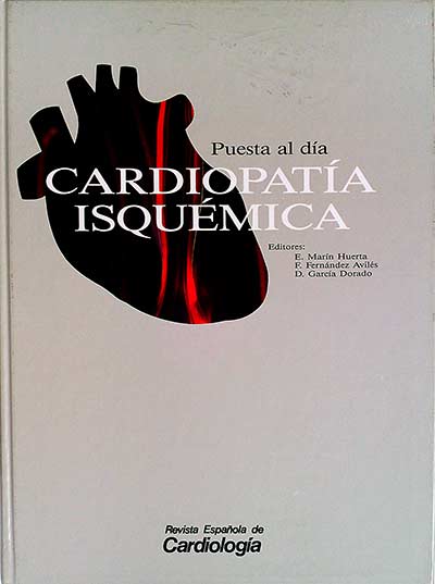 Cardiopatía isquémica