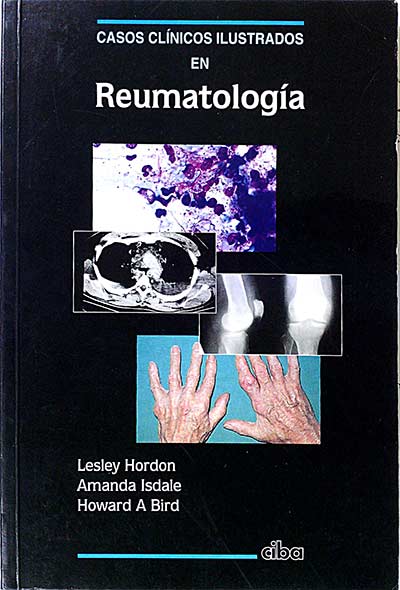 Casos clínicos ilustrados en reumatología