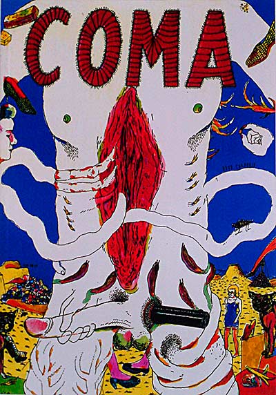 Coma