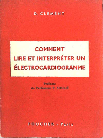 Comment Lire et interpréter un électrocariogramme