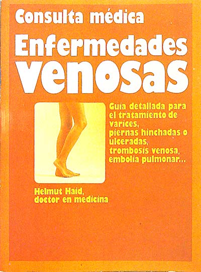 Consulta médica, enfermedades venosas