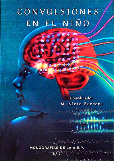 Convulsiones en el niño