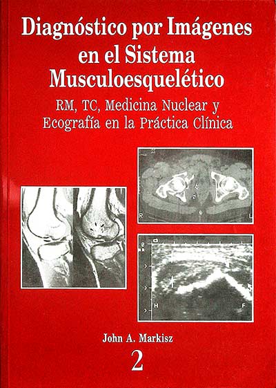 Diagnóstico por imágenes en el sistema musculoesquelético (2)