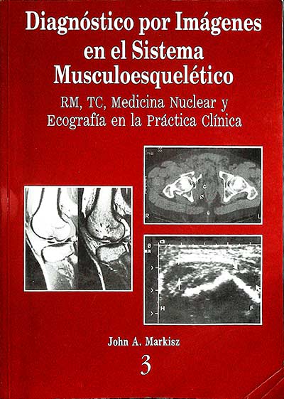 Diagnóstico por imágenes en el sistema musculoesquelético (3)