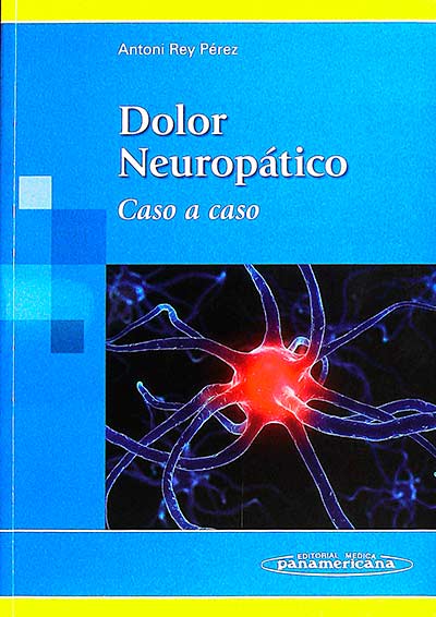 Dolor neuropático. Caso a caso