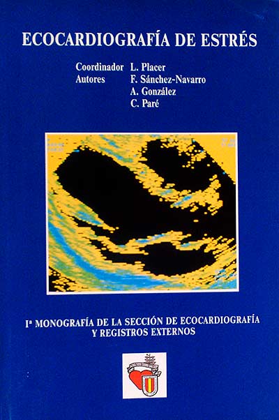 Ecocardiografía de estrés