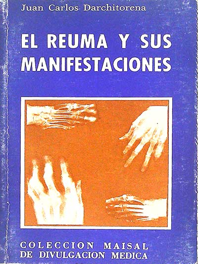 El reuma y sus manifestaciones
