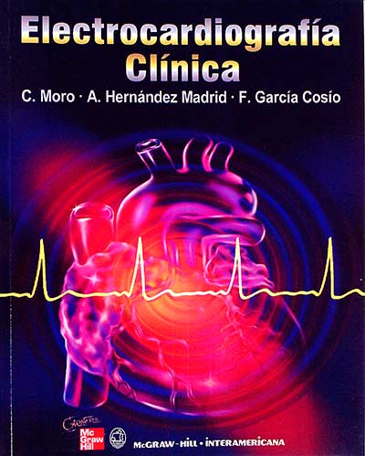 Electrocardiografía clínica