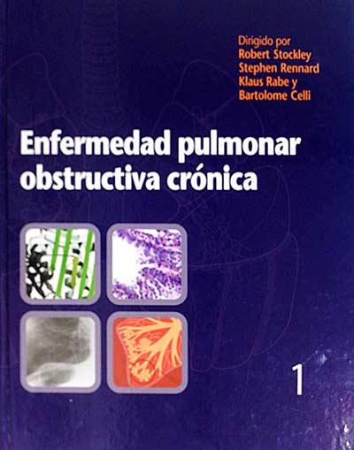 Enfermedad pulmonar obstructiva crónica 1