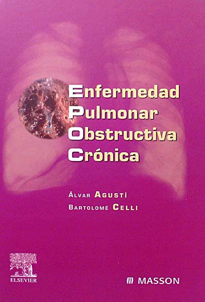 Enfermedad pulmonar obstructiva crónica