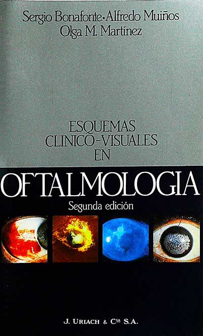 Esquemas clínico-visuales en Oftalmología