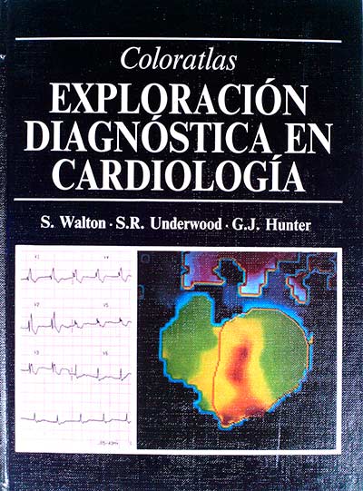 Exploración diagnóstica en cardiología