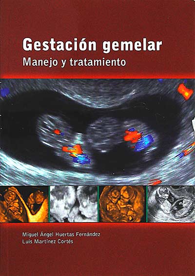 Gestación gemelar