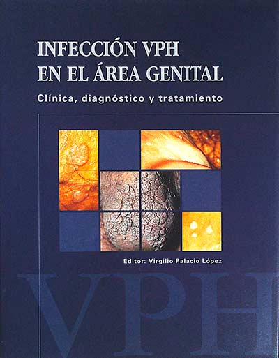 Infección VPH en el área genital
