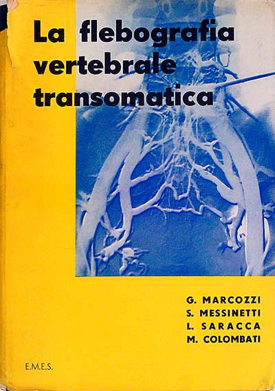 La flebografía vertebrale transomática 