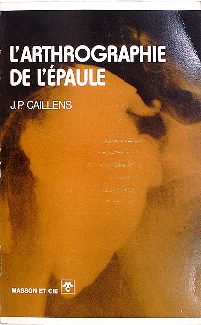 L'arthrographie de l'épaule