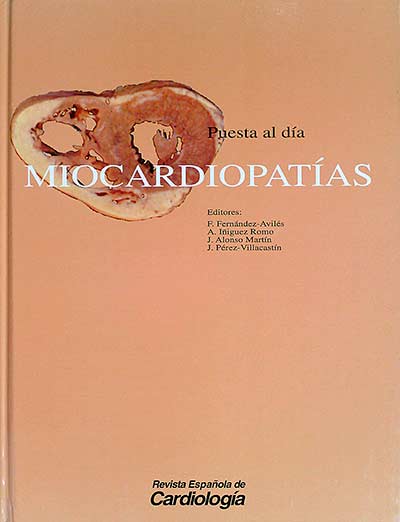 Miocardiopatías