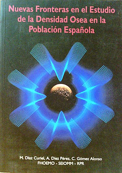 Nuevas Fronteras en el Estudio de la Densidad Osea en la Población Española
