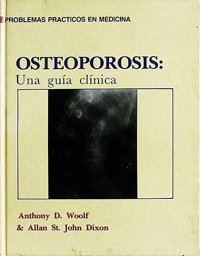 Osteoporosis: Una guía clínica
