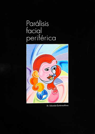 Parálisis facial periférica