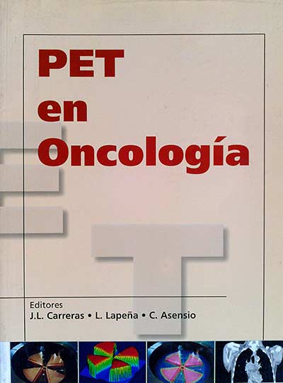 PET en oncología
