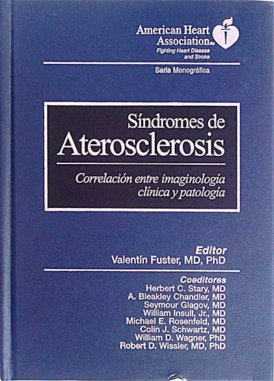 Síndromes de Aterosclerosis
