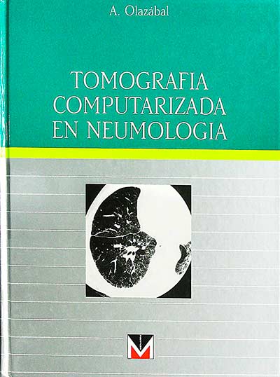 Tomografía computerizada en neumología