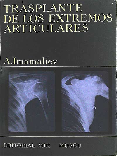 Trasplante de los extremos articulares