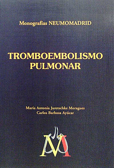 Tromboembolismo pulmonar. 