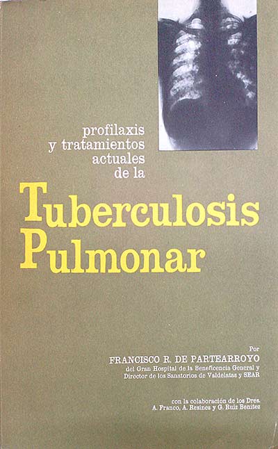 Tuberculosis pulmonar