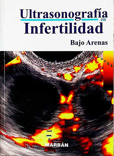Ultrasonografía en infertilidad