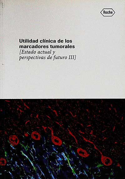 Utilidad clínica de los marcadores tumorales 