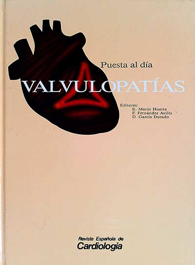 Valvulopatías